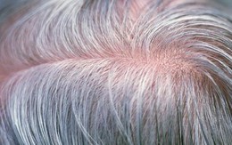 Lý do tóc chúng ta bạc đi khi về già