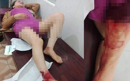 Chị dâu tố em rể hành hung phải nhập viện với nhiều thương tích
