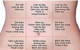 Chuyên gia đầu ngành tiêu hóa chỉ cách đoán bệnh qua vị trí đau vùng bụng ai cũng nên biết