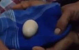 Thiếu niên khiến bác sĩ đau đầu khi 'đẻ 20 quả trứng' trong 2 năm