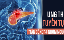 Ung thư tụy rất nguy hiểm vì khó chữa, ai có 4 đặc điểm này hãy đặc biệt cẩn thận