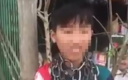 Bé trai bị quấn nhiều vòng xích quanh cổ, nghi vì tội trộm vàng