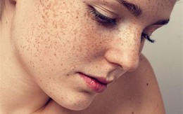 Mỗi ngày bỏ ra 2 nghìn, kể cả nám và tàn nhang lâu năm cũng trị hiệu quả dứt điểm!