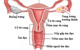 7 dấu hiệu ung thư buồng trứng mọi phụ nữ cần cảnh giác