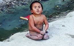 Bé gái tàn tật, trần truồng giữa trời đông lạnh giá ở Mường Lát đã được thai phụ Sài Gòn nhận làm con nuôi
