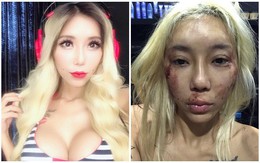 Nữ DJ gợi cảm đăng hình ảnh tàn tạ, rớm máu và sự thật gây sốc