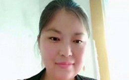 Phẫn nộ người phụ nữ bị biến dạng hoàn toàn sau khi bị chồng cũ trả thù tàn độc