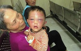 Triệu tập bố dượng đánh con riêng 2 tuổi của vợ phù nề, bầm tím mặt