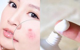 Bất ngờ trước cách trị mụn bọc chẳng tốn bao nhiêu tiền với kem đánh răng!