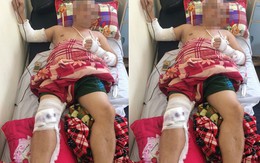Đi ăn đêm, người đàn ông bị chém gục tại quán