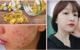 Bôi vitamin E lên mặt để dưỡng da, chị em nhận được kết quả hơn cả mong đợi!