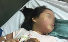 Thực hư vụ bé gái 5 tuổi phải nhập viện Bạch Mai khẩn cấp nghi do ngộ độc trà sữa