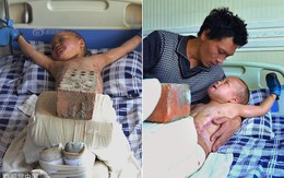 Xót xa chuyện người đàn ông bị vợ bỏ rơi, mỗi ngày dùng 15kg gạch đè lên chân đứa con 5 tuổi để chữa bỏng