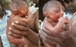 Bố mẹ nhẫn tâm bỏ đói đến chết con gái 2 tuần tuổi vì con có ngoại hình khác thường, may mắn thay vị cứu tinh đã xuất hiện