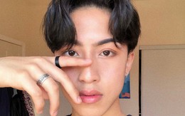 Từng bị chê bai vì má đầy mụn, anh chàng này đã chữa khỏi hoàn toàn sau khi đổi chu trình dưỡng da