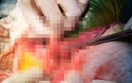 Phụ huynh quên tắt máy, bé trai 2 tuổi vặn ga xe máy đè thủng ruột bạn cùng lớp