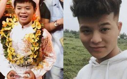Sao nhí bị nghi ngờ dao kéo vì gương mặt đẹp hơn hẳn quá khứ