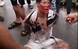 Cha bé gái bị kẻ lạ mặt bế đi: 'Phúc nhà tôi còn dày nên chưa mất con'