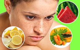 16 nguyên liệu rẻ tiền nhưng có tác dụng thần kỳ giúp loại bỏ các vết nám và tàn nhang trên mặt
