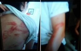 Hà Nội: 2 cháu bé bị bố đẻ khóa trái cửa bạo hành dã man, bà ngoại gửi đơn cầu cứu