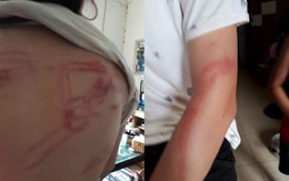 Hà Nội: Nghi vấn 2 cháu bé bị bố ruột bạo hành dã man
