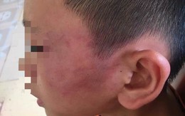 Nỗi đau của cậu bé vừa chào đời đã mồ côi mẹ