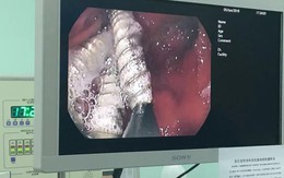 Để con nhỏ 3 tuổi trông em mới 37 ngày tuổi, trong phút chốc đã thấy con sùi bọt mép vì thứ kinh khủng này