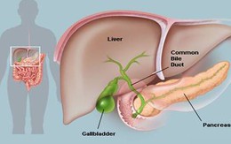 6 dấu hiệu đã đến lúc bạn cần thải độc gan