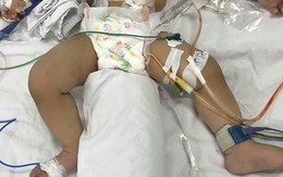 Bé trai 11 tháng tuổi bị mẹ ruột dùng dao đâm nhiều nhát vào bụng nguy kịch