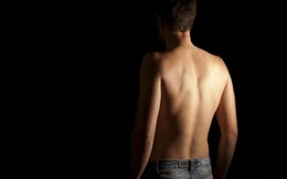Cô vợ phát hiện chuyện ngoại tình nhờ chiếc mụn ở lưng chồng