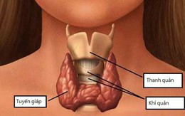 Chuyên gia cảnh báo nếu thấy dấu hiệu này, nhiều khả năng bạn mắc bệnh về tuyến giáp