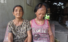 Bà nội bé gái bị tạt axit năm 7 tuổi vì mẹ 'giật chồng' người khác rồi bỏ rơi đã đến TP.HCM để xin đôi mắt tử tù cứu cháu