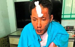 Bực tức vì bị vợ đuổi ra khỏi nhà, chồng mua xăng về đốt khiến 3 mẹ con nguy kịch
