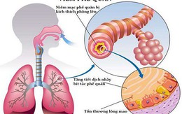 Chuyên gia cảnh báo bệnh viêm tiểu phế quản ở trẻ khi thời tiết giao mùa