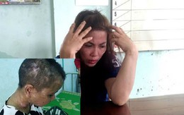 Lạnh người lời khai của bà chủ tra tấn cô gái giúp việc như thời trung cổ