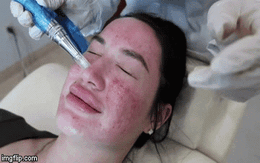 Một trong những điều tồi tệ nhất khi có tuổi là làn da chảy xệ, nhưng liệu chúng ta có thể ngăn được tình trạng này?