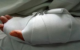 Đưa người đi cấp cứu sau hỗn chiến, thanh niên bị chém đứt cổ tay