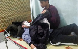 Nam sinh bị bỏng nặng do 'đốt thử xăng'