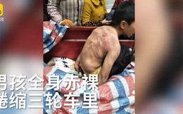 Bị bố mẹ đánh tím người, bé 10 tuổi mình trần ngủ dưới trời lạnh âm 2 độ