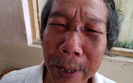 Bảo vệ đánh nhà thơ 68 tuổi ngất xỉu từng đi tù vì buôn bán ma túy