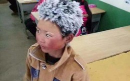Cậu bé tóc đóng băng ở Trung Quốc được hỗ trợ hàng triệu đô