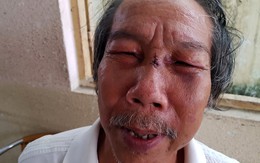 Bảo vệ đánh nhà thơ 68 tuổi ngất xỉu