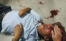 Bảo vệ chung cư đánh cụ ông như phim chưởng: Việc bắt giữ hay không phụ thuộc vào quá trình điều tra