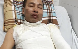 Hà Nội: Bố bị tạt a-xít, con 9 tuổi gào khóc trong xe