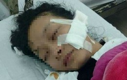 Khởi tố vụ nữ sinh lớp 11 bị rạch mặt ở chợ