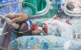 Chị em sinh ba chào đời cách nhau hai ngày