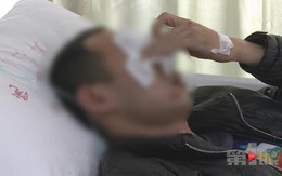 Vì mâu thuẫn nhỏ, chú rể bị nhà gái đánh đến nhập viện ngay trước lễ cưới