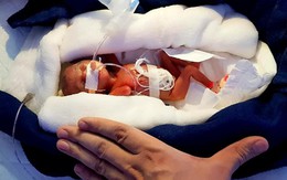 Bé gái sinh ra nhỏ xíu chưa bằng bàn tay, bác sĩ không dám tiên lượng điều gì thì 6 tháng điều kỳ diệu đã xảy ra