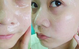 Tối nào cũng thoa một giọt này, da bạn sẽ trắng mịn, hồng hào như da em bé