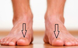 Bàn chân xuất hiện cùng lúc 3 dấu hiệu này: Hãy cảnh giác vì có thể thận đang có bệnh